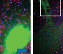 blurred and shapr images of a mouse brain slice as seen through a microscope